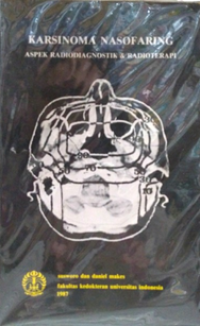 Image of Karsinoma Nasofaring