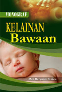 Image of Kelainan Bawaan