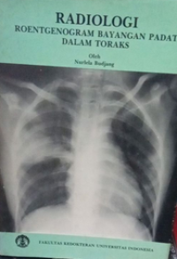 Image of Radiologi Roentgenogram Bayangan Padat dalam Toraks