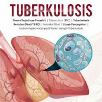 Image of Tuberkulosis